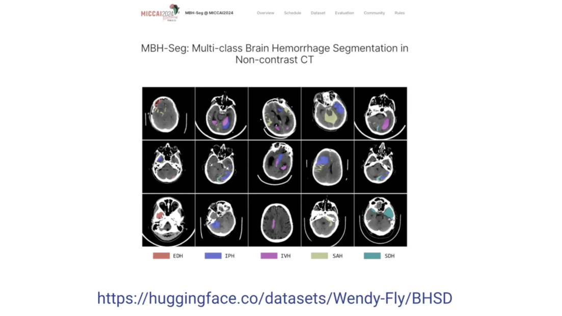 screenshot of video AI in Radiology: Challenge Accepted